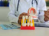 Step-by-Step Dental Implant Procedure Guide for Woodlands Patients